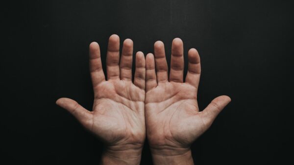 Nadpotliwość dłoni – jak sobie z nią poradzić?