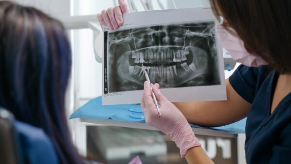 Przewodnik dla pacjentów po rentgenie zębów