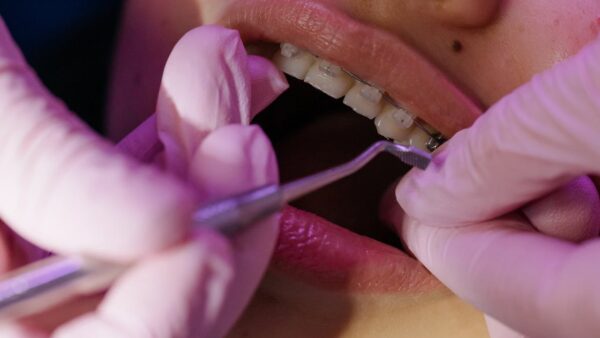 Ortodoncja – co warto wiedzieć o tej dziedzinie stomatologii?